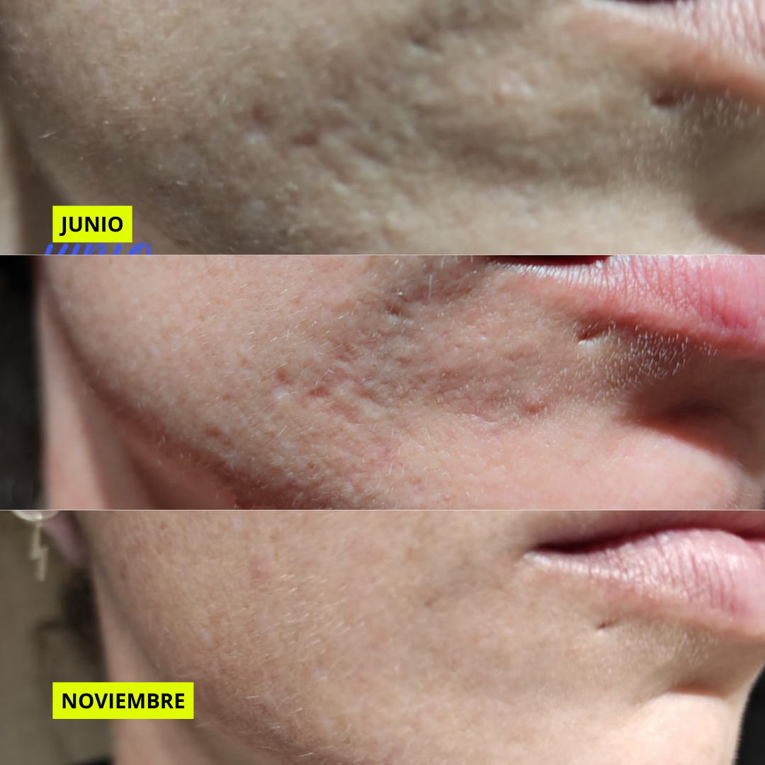 AM&PM ROUTINE Micellar W + AOX + Starter R + GGlow + Power H