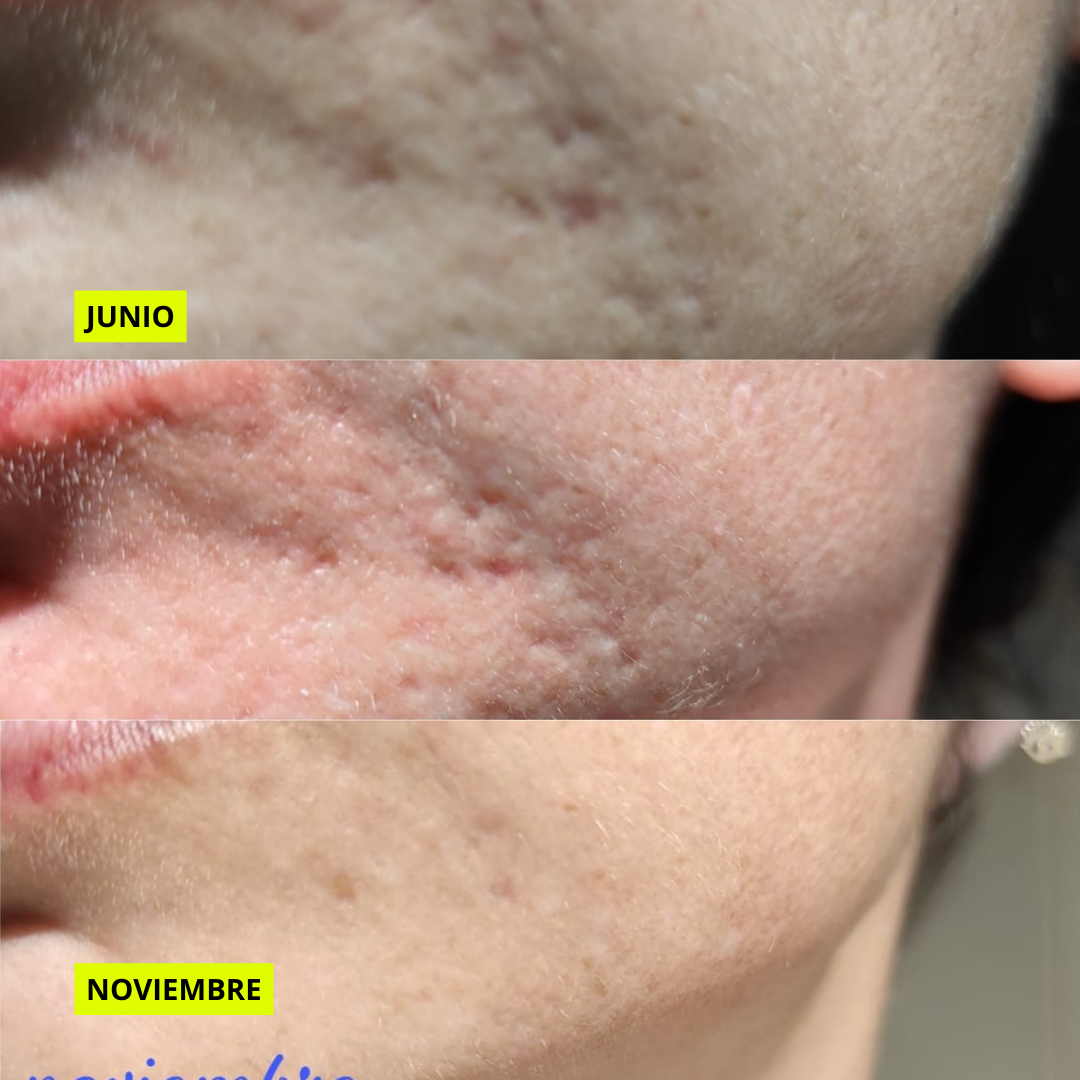 AM&PM ROUTINE Micellare W + AOX + Starter R + GGlow + Power H