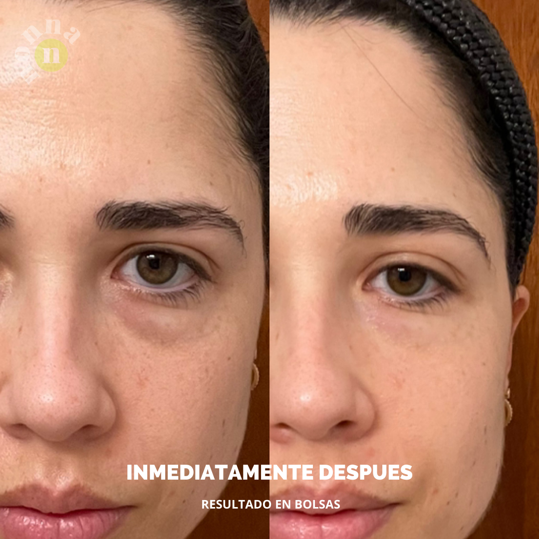 E COMPLEX Contorno de ojos - bolsas + ojeras