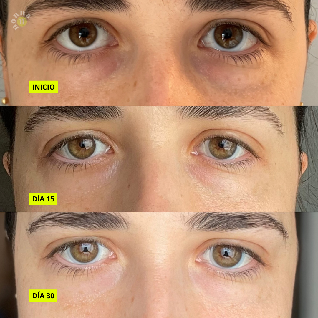 E COMPLEX Contorno de ojos - bolsas + ojeras