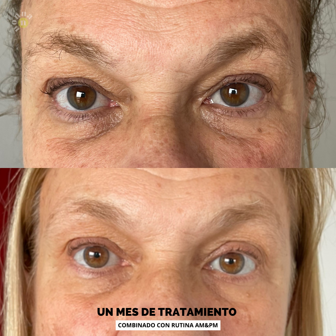 E COMPLEX Contorno de ojos - bolsas + ojeras