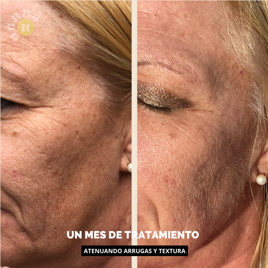 MINI STARTER R - 0,15% RETINOL + 5% NIACINAMIDA