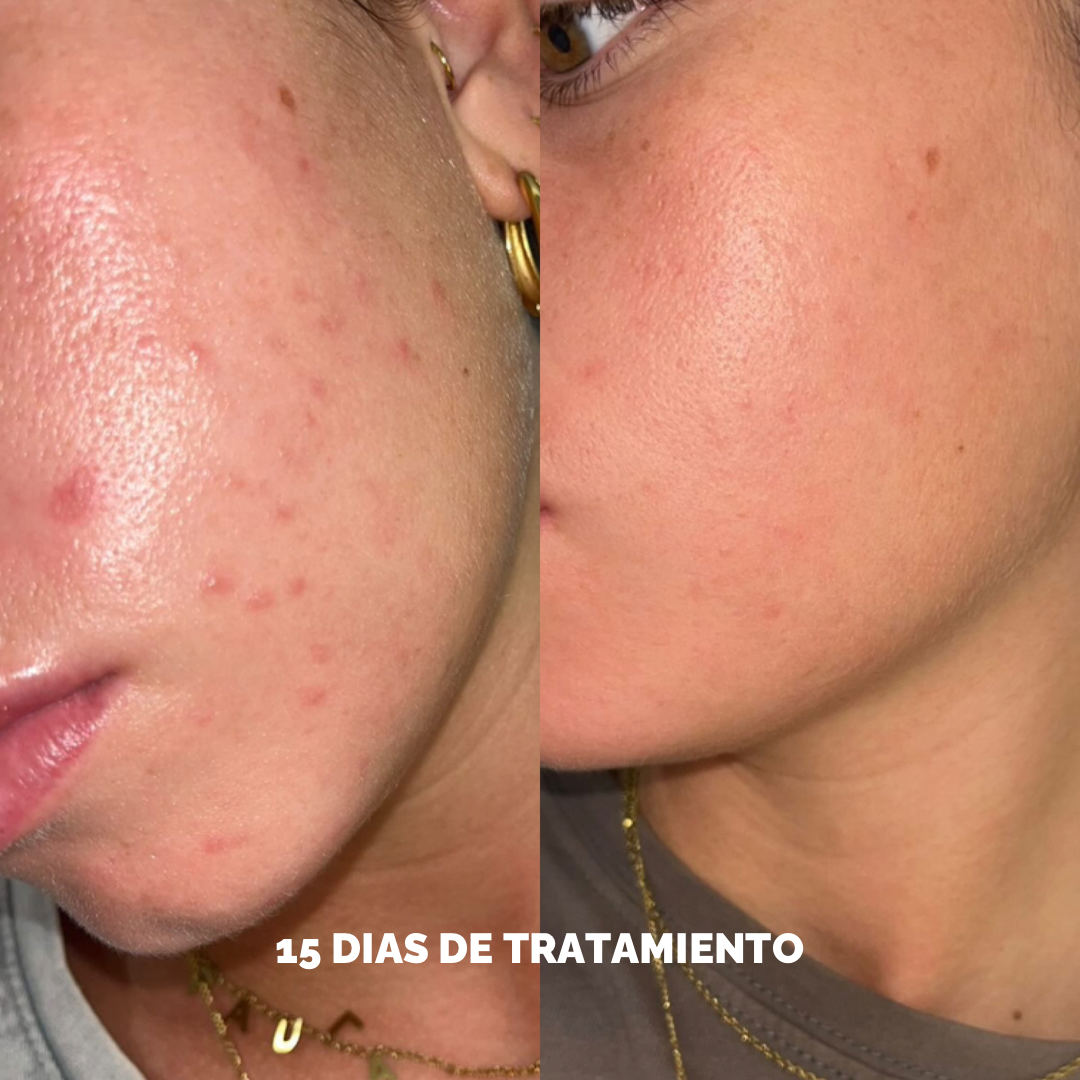 GGLOW Exfoliante - 5% Ácido Glicólico & Niacinamida