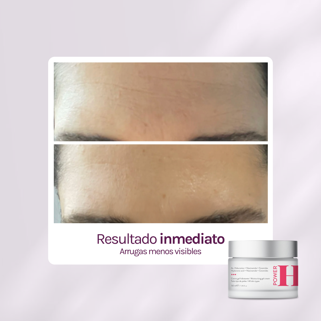 POWER H Hidratante c/ Hialurónico, Ceramidas & Niacinamida