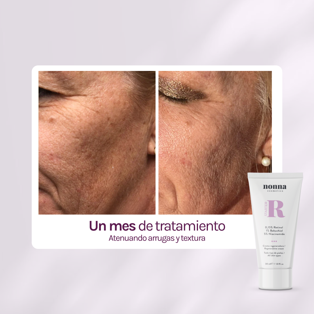 STARTER R - Retinol 0,15% + 5% Niacinamida