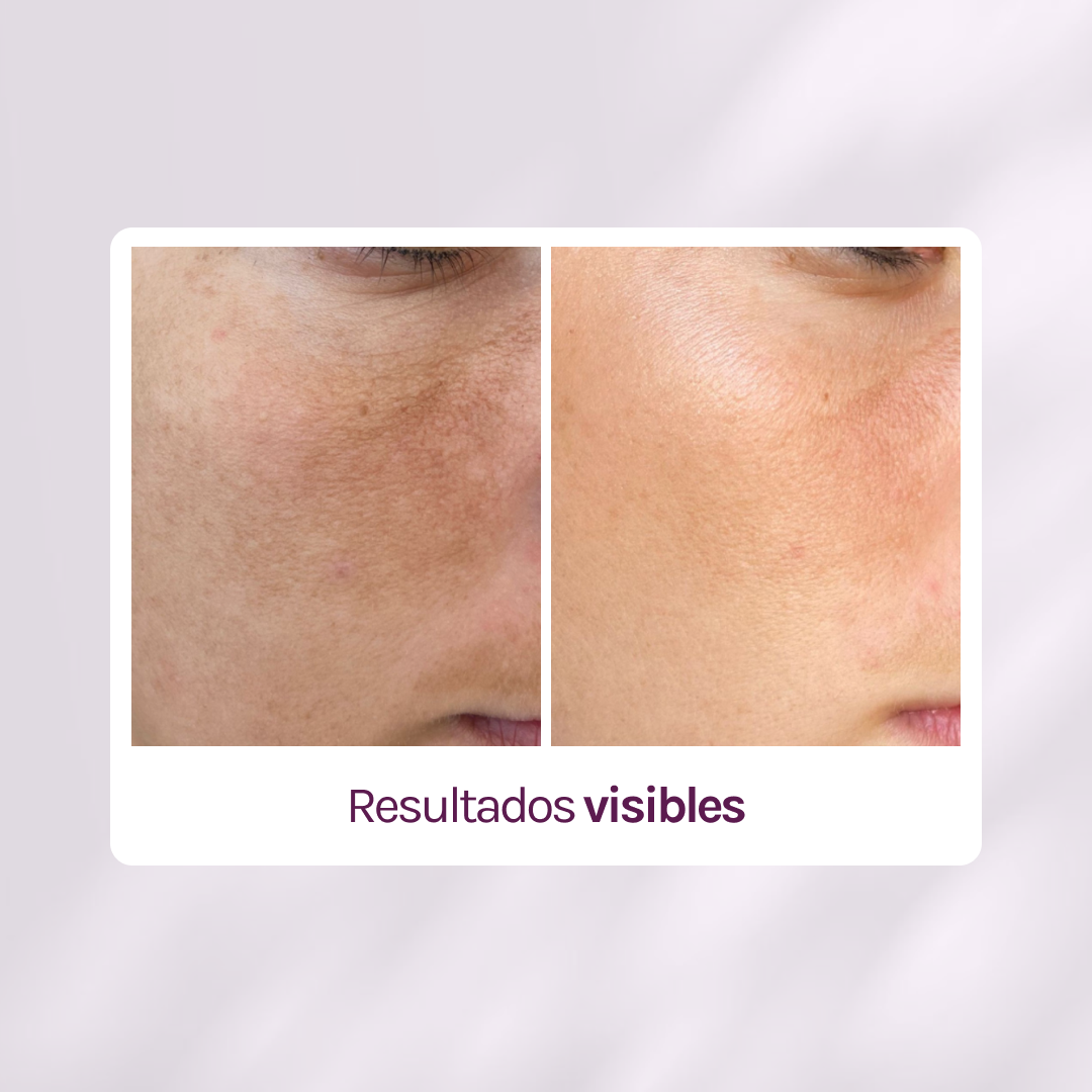 SUPER RUTINA - RUTINA AM&PM + CONTORNO DE OJOS