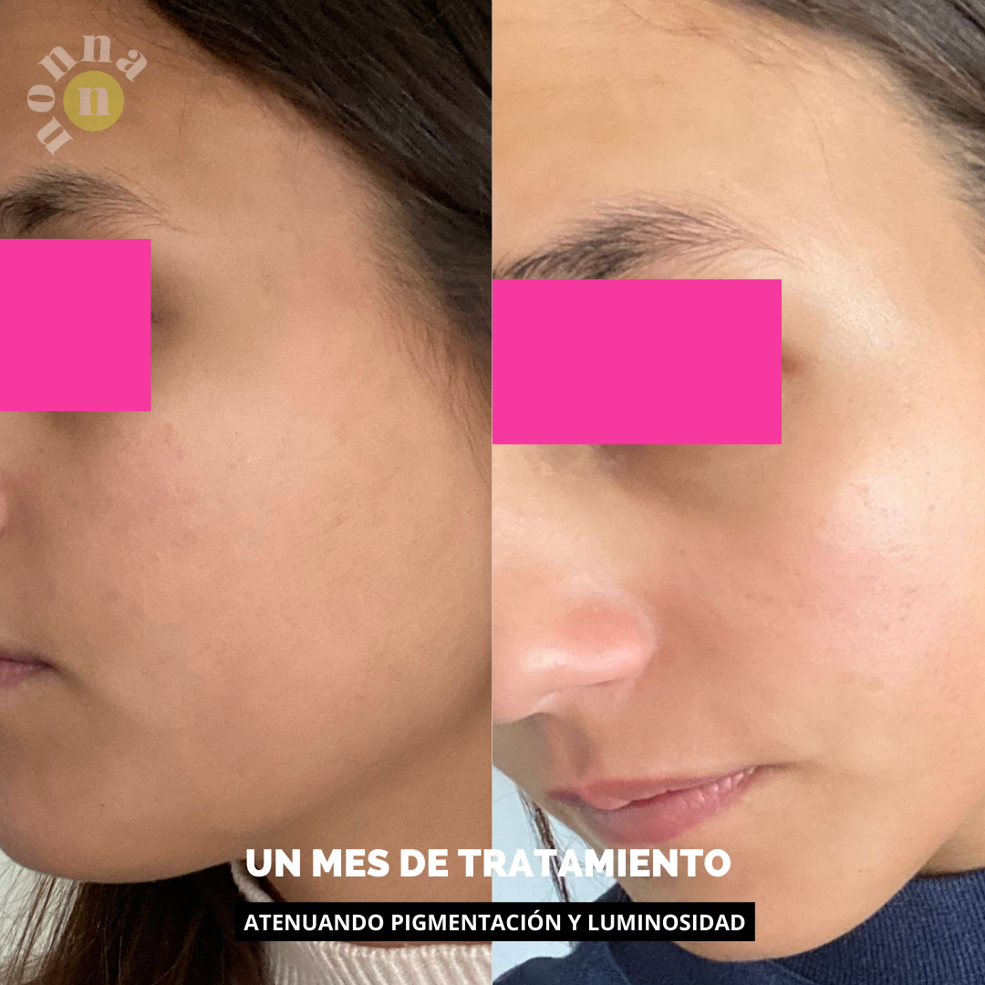 A.O.X Booster Antioxidante con vitamina C