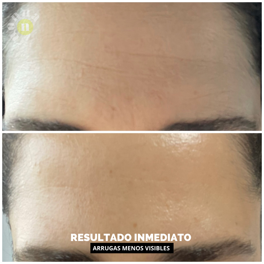 Crema idratante POWER H con acido ialuronico, ceramidi e niacinamide