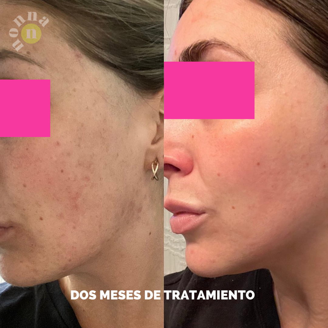 RUTINA PM ANTIAGE - ARRUGAS + FIRMEZA