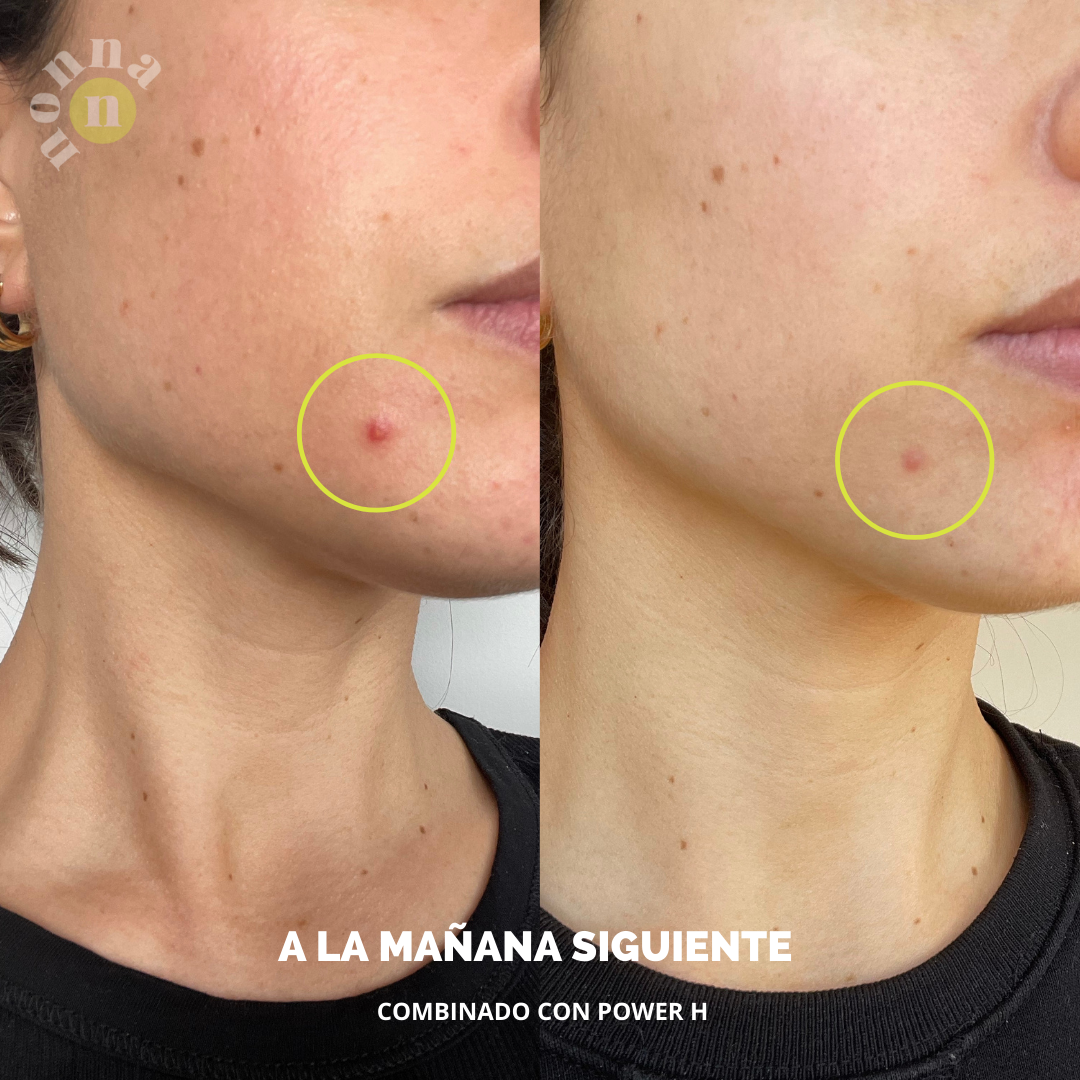 GGLOW Exfoliante - 5% Ácido Glicólico & Niacinamida