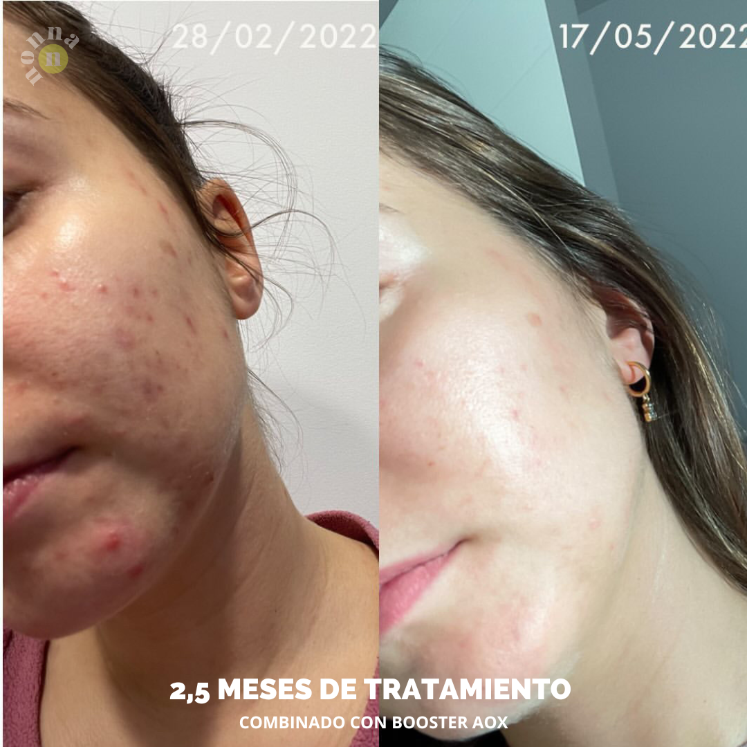 RUTINA PM GLOW - GRANITOS + POROS