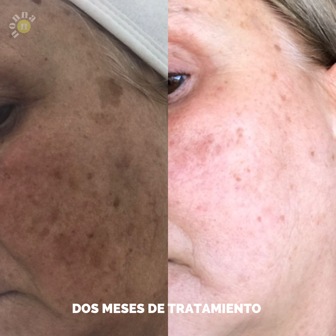 AM&PM ROUTINE Micellar W + AOX + Starter R + GGlow + Power H