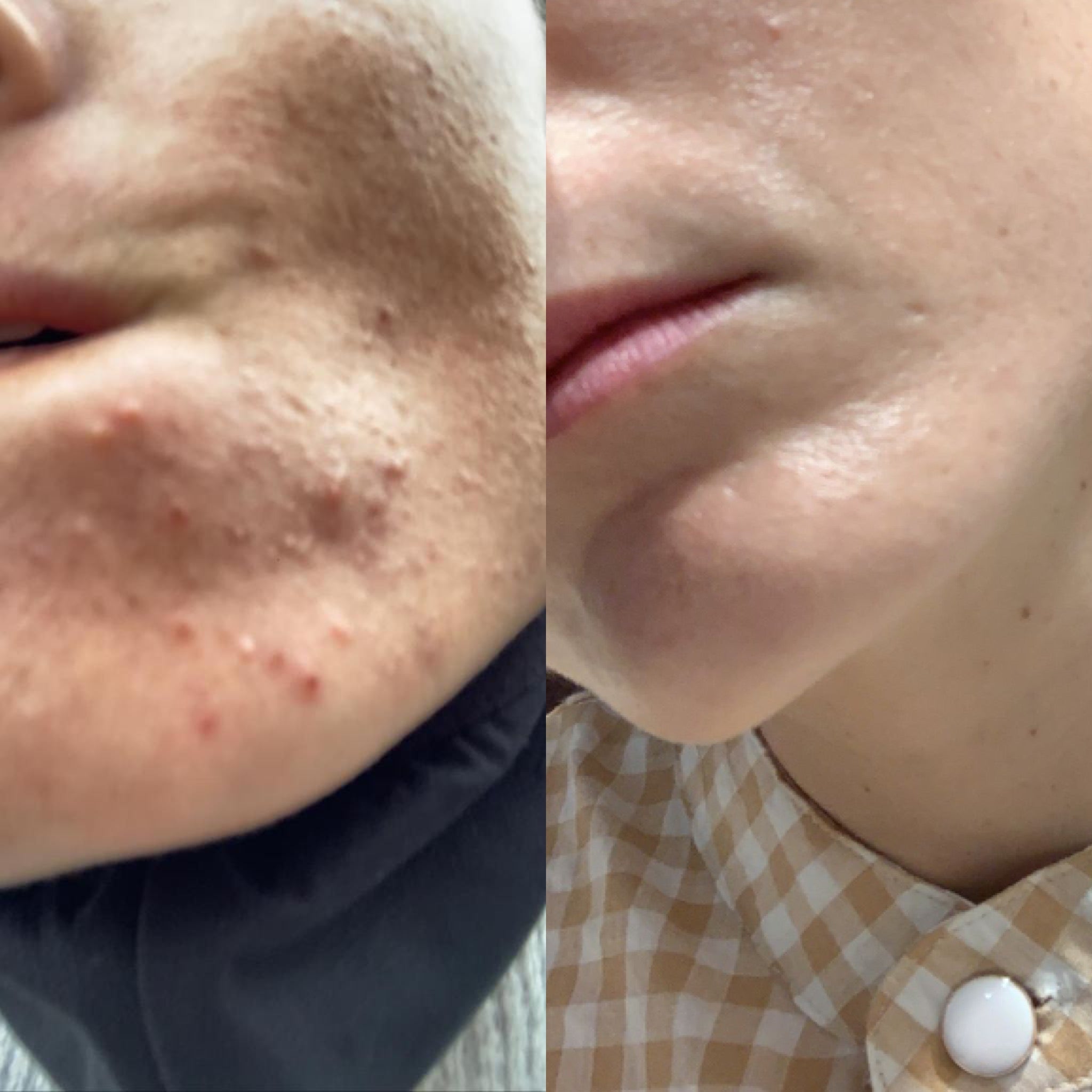 KIT DI TRATTAMENTO Booster AOX + GGlow + Starter R