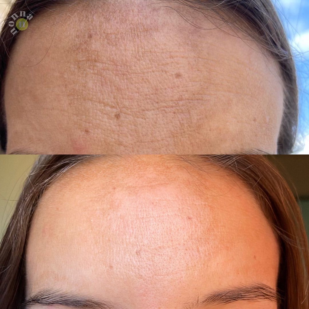 AM&PM ROUTINE Micellar W + AOX + Starter R + GGlow + Power H