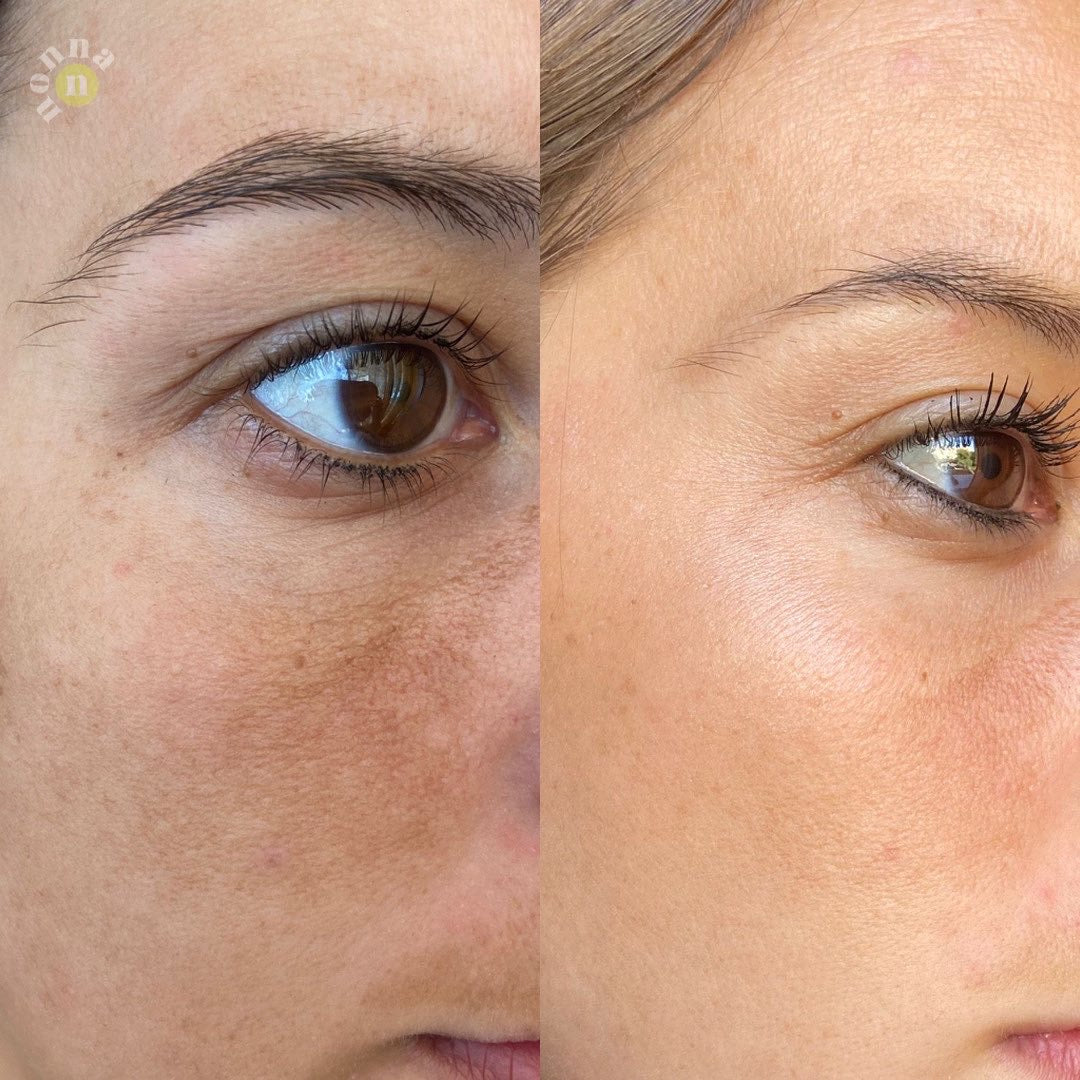 SUPER RUTINA - RUTINA AM&PM + CONTORNO DE OJOS