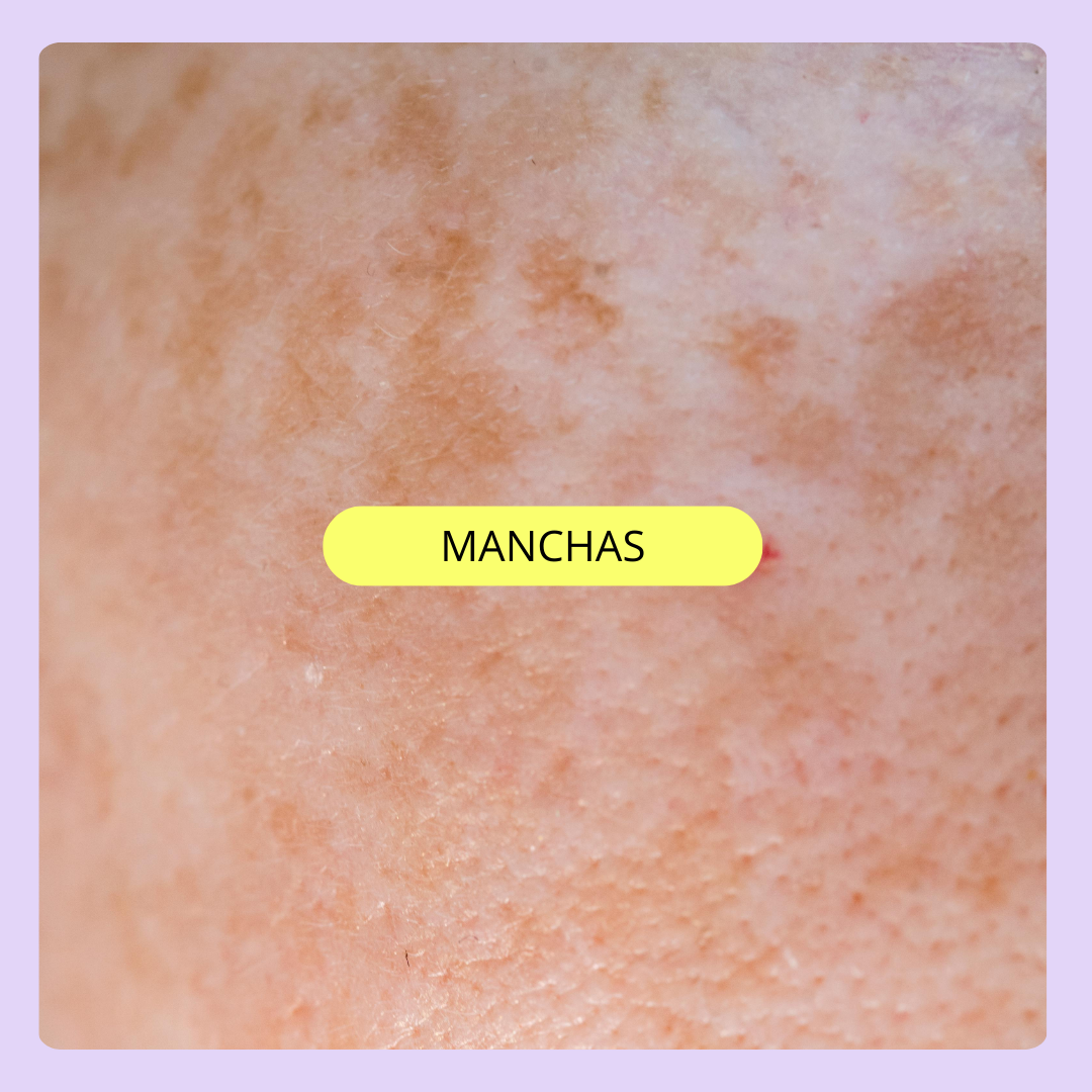 MANCHAS