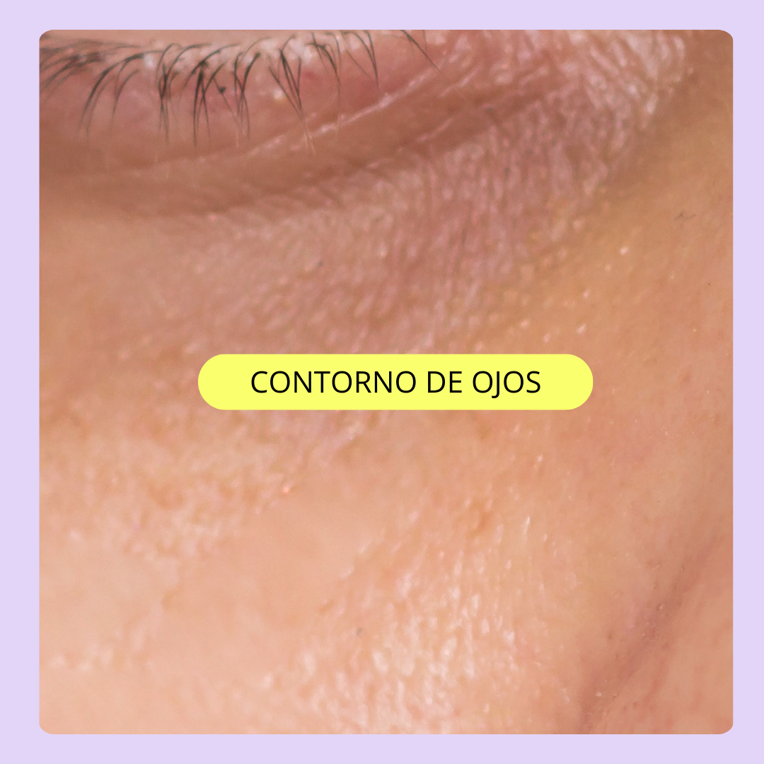 CONTORNO DE OJOS