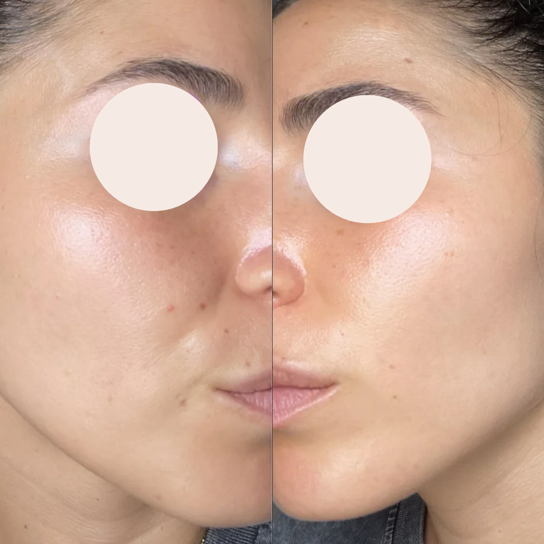 ROUTINE AM Micellare W + AOX + Power H