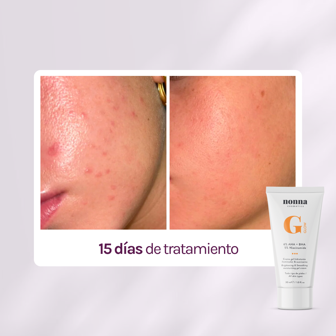 GGLOW Exfoliante - 5% Ácido Glicólico &amp; Niacinamida