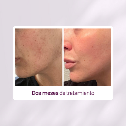 RUTINA AM - PIEL CANSADA + HIDRATACIÓN