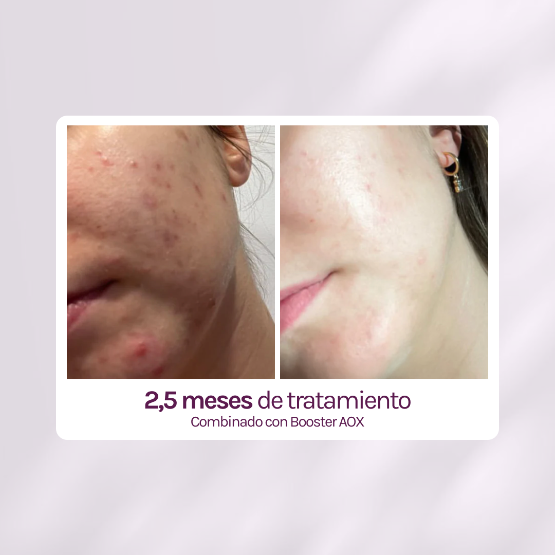 RUTINA PM GLOW - GRANITOS + POROS