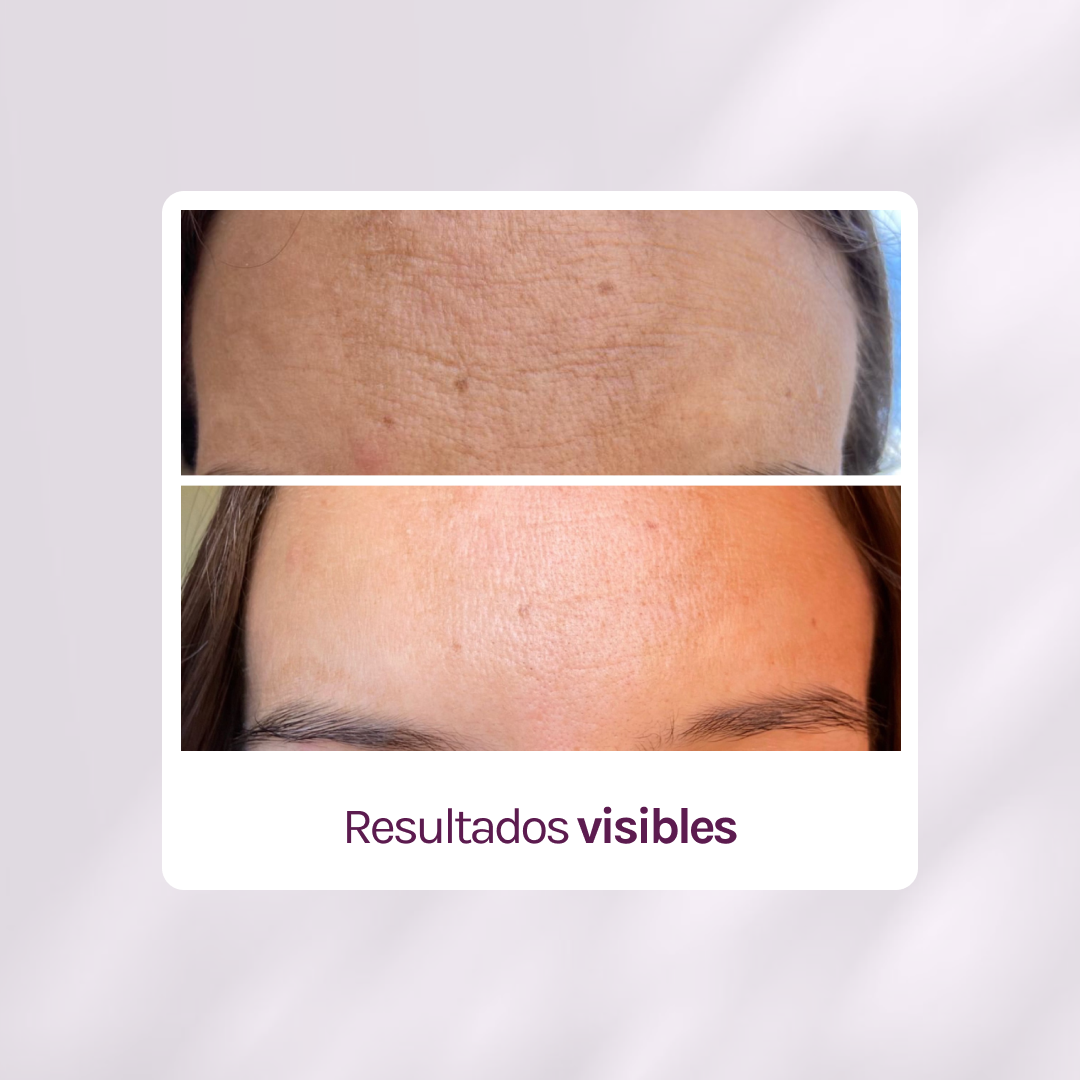 SUPER RUTINA - RUTINA AM&amp;PM + CONTORNO DE OJOS